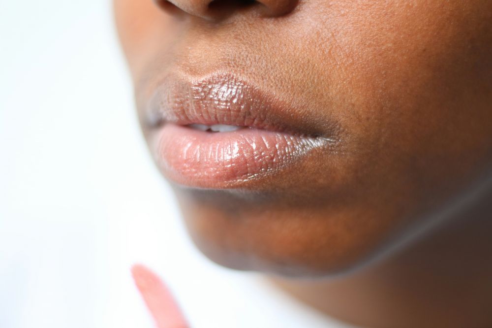 Fillers: En guide til moderne ansiktsbehandling
